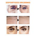 Anti-Aging Gesichtsmaske mit Kollagen & Hyaluronsäure | intensiv feuchtigkeitsspendend | glättender Aufpolster-Effekt | strahlender Teint 4